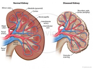 npml_0003_normal_versus_diseased-1030x772