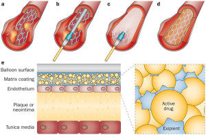 stents part 2