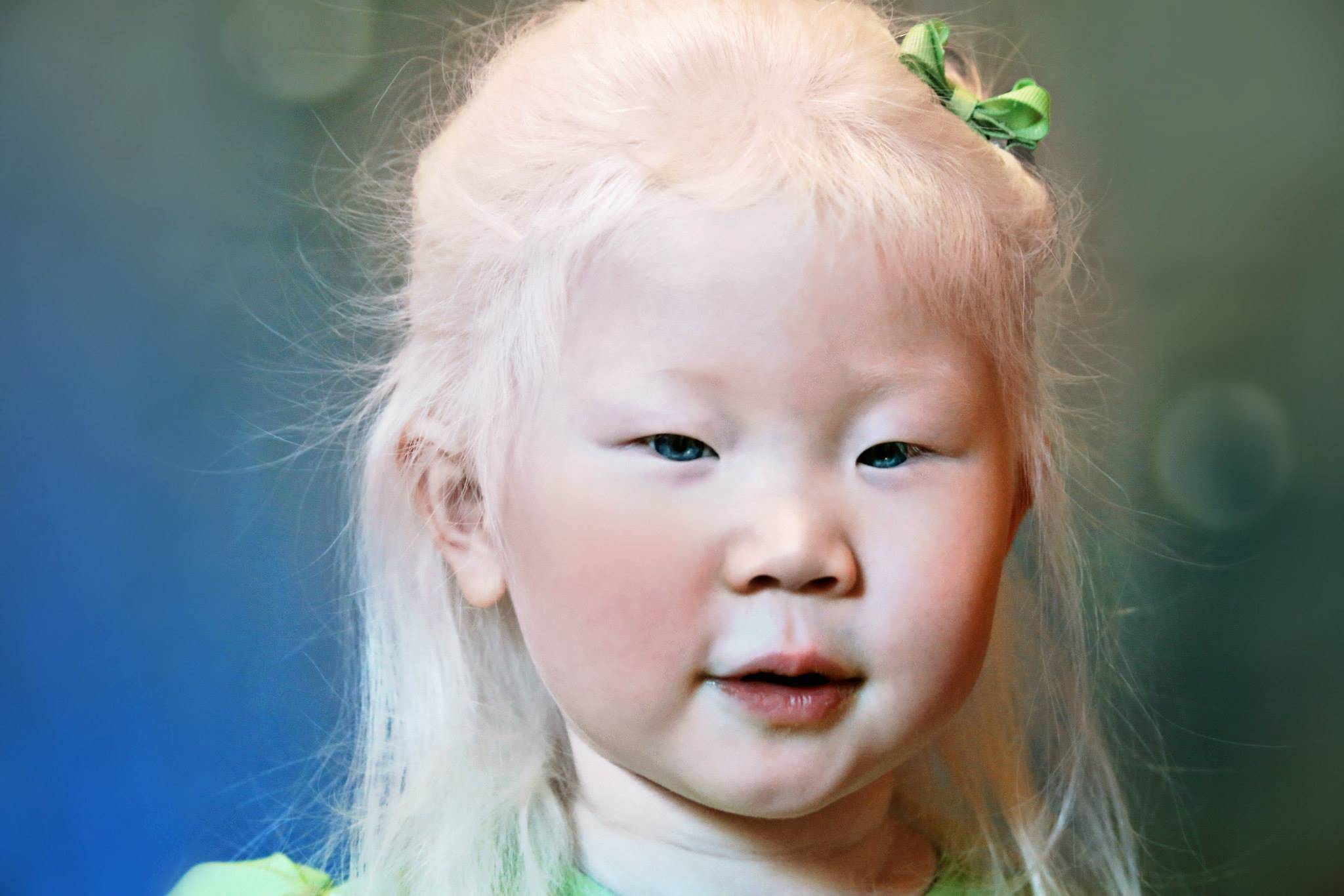 Монголоиды альбиносы