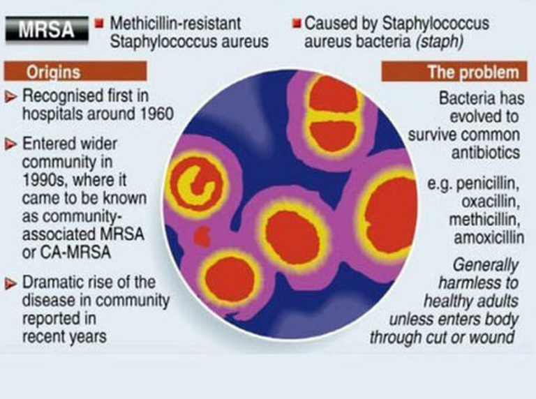 mrsa-and-vre-types-of-hospital-acquired-resistant-infections-strive