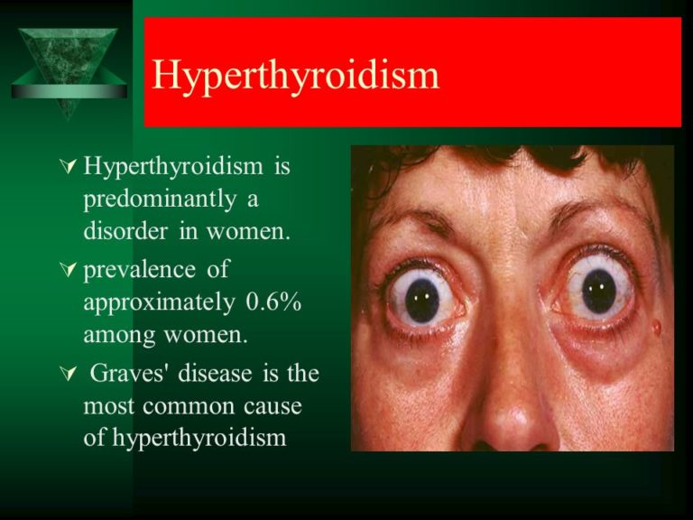 Part Iii Thyroid Disease Awareness Month Hyperthyroidism Strive For Good Health 