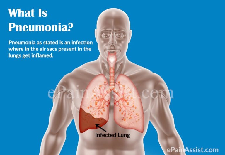 Respiratory Care Week; Acute lower respiratory infections! | Strive For ...