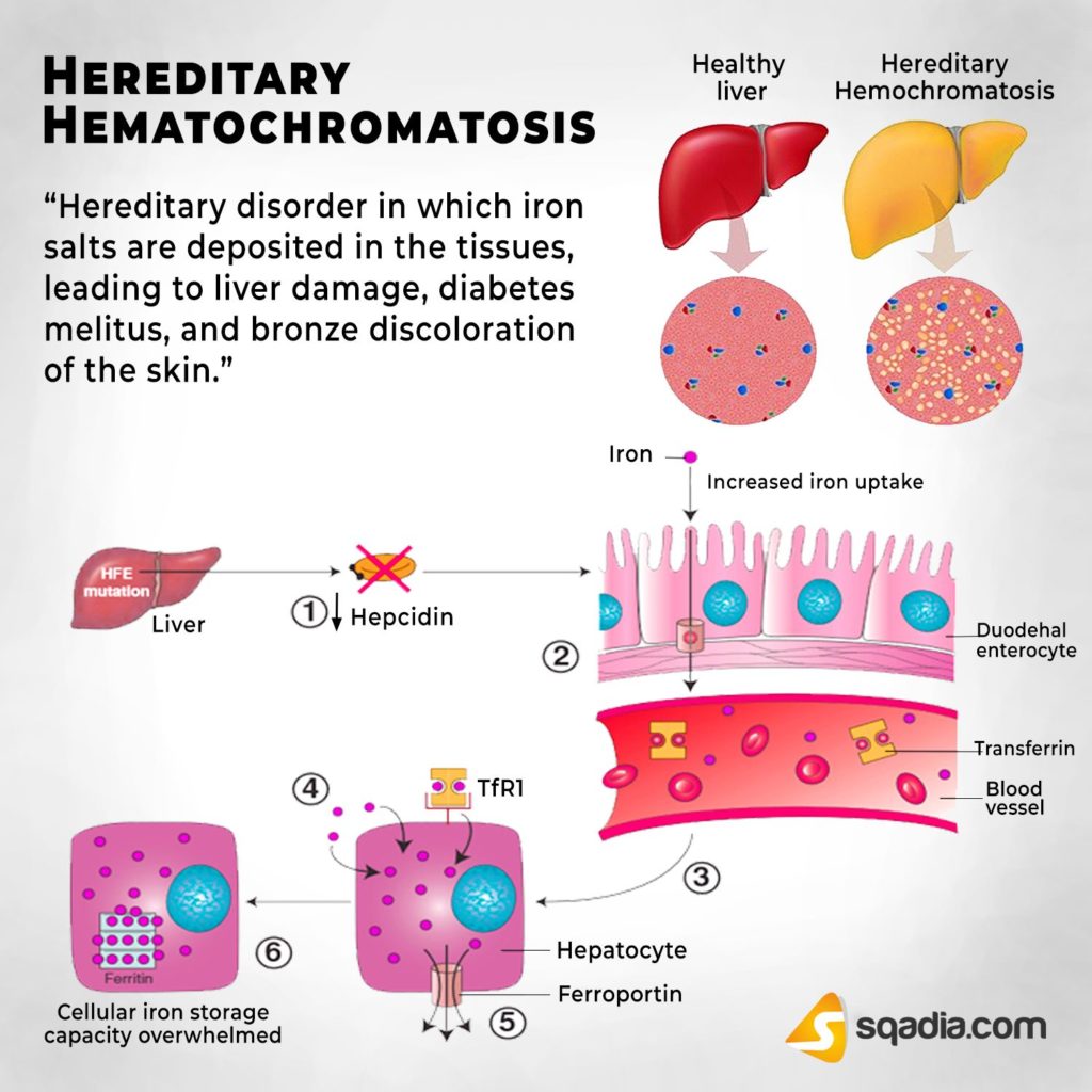 Part I Hemochromatosis Strive For Good Health